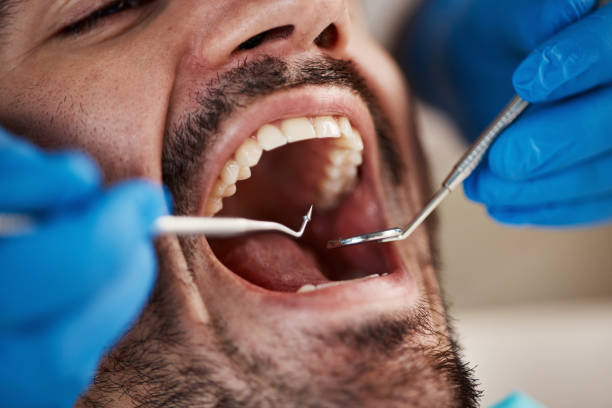 Best Dental Fillings (Composite and Amalgam)  in Cedaredge, CO